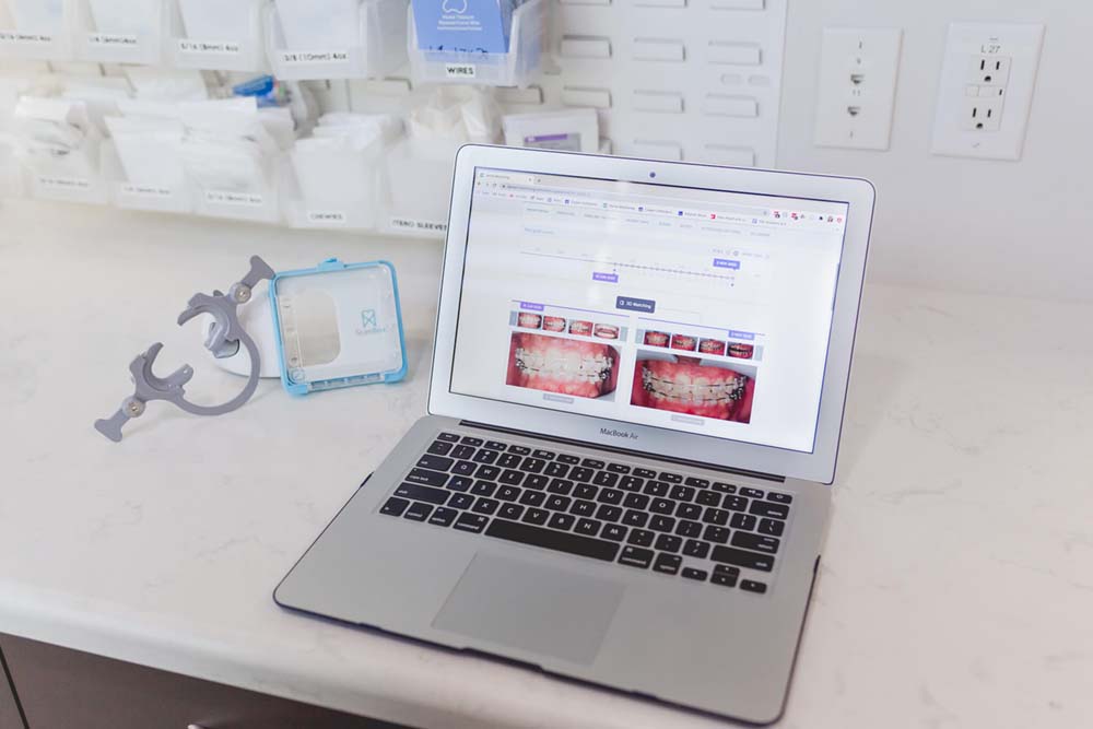 Dental Monitoring - Cooper Orthodontics
