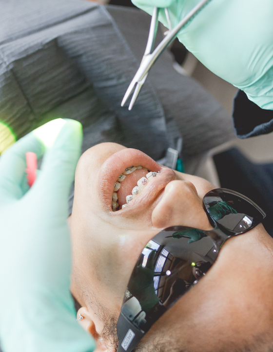 Braces for Teens - Cooper Orthodontics in Houston & Lake Jackson, TX