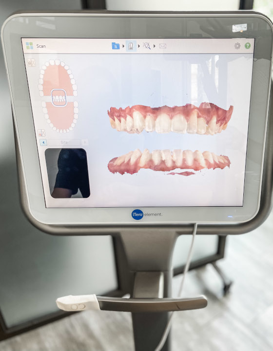 3D Scanning - Cooper Orthodontics in Houston & Lake Jackson, TX