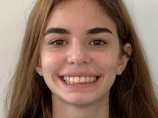 Braces for Teens in Rice Military Texas