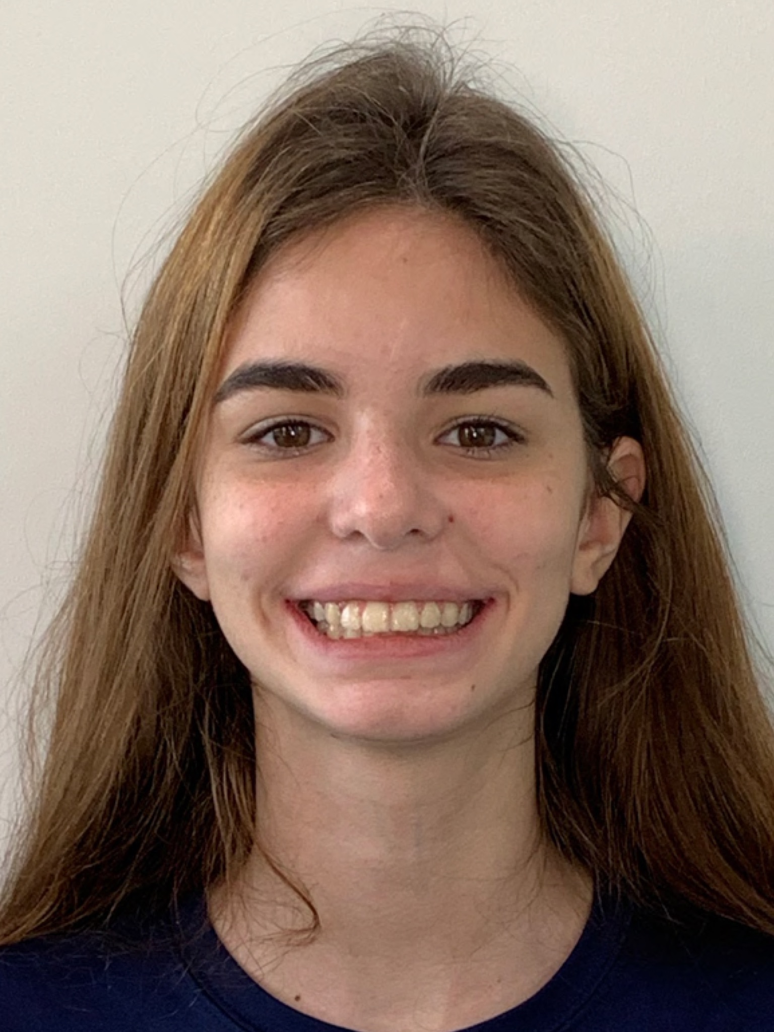 Braces for Teens in Rice Military Texas