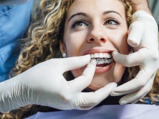 What Orthodontic Issues Can Invisalign Fix?